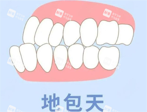 地包天動(dòng)畫展示圖 地包天動(dòng)畫展示圖