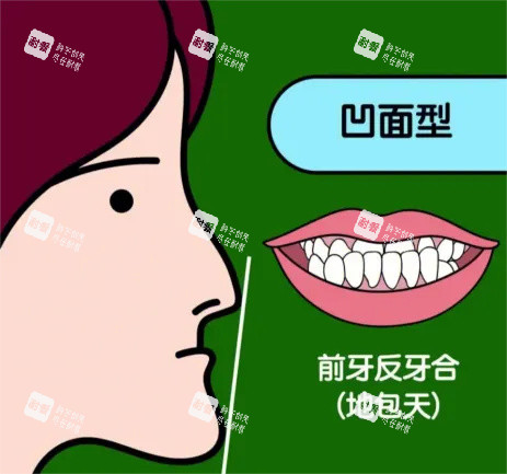 地包天漫畫示意圖 地包天漫畫示意圖