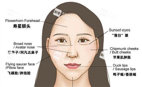 饅化臉出現(xiàn)的問題