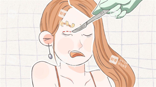 雙眼皮手術(shù)失敗修復(fù)卡通圖片