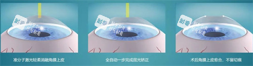 南方醫(yī)科大學(xué)順德醫(yī)院眼科怎么樣?本地人氣醫(yī)院,手術(shù)需提前預(yù)約排號!