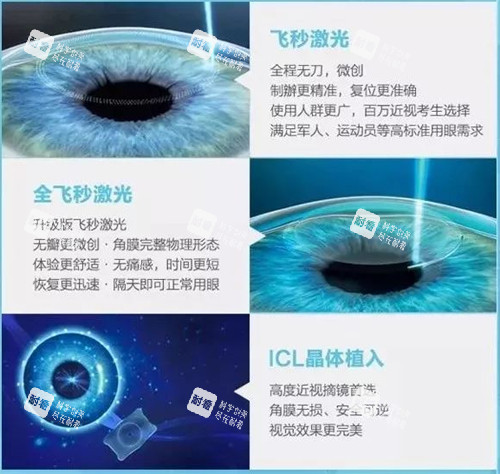 不同近視手術(shù)的區(qū)別