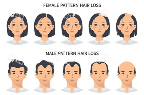 男女生發(fā)際線對比