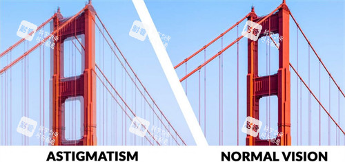 散光眼睛和正常眼睛看東西的區(qū)別