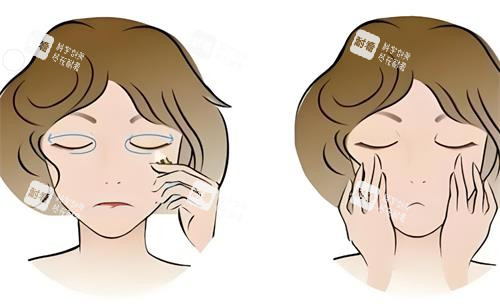 去眼袋前后對比動畫圖