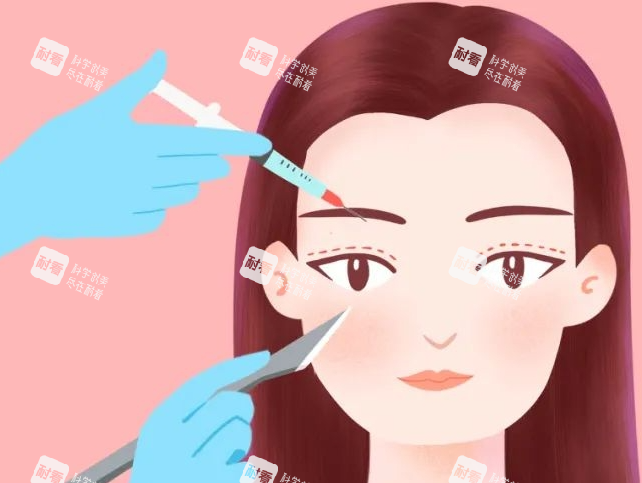 雙眼皮畫線展示圖