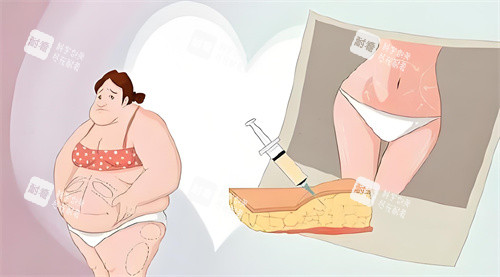 抽脂手術前后對比動畫圖