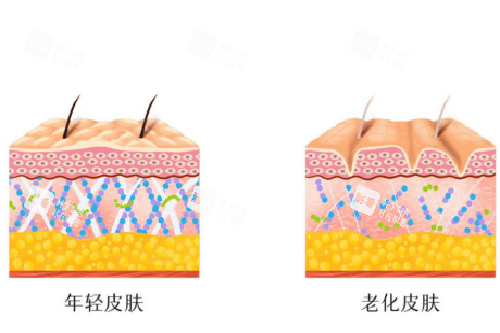 平滑皮膚和有皺紋皮膚示意圖
