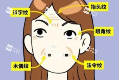 面部皺紋詳細(xì)示意圖