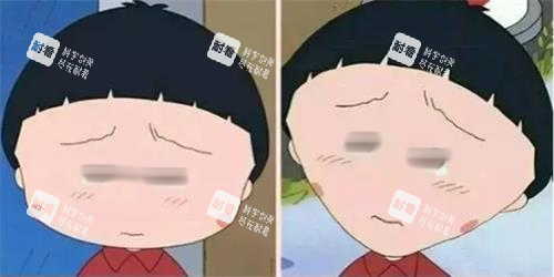 打針瘦臉前后明顯對比圖