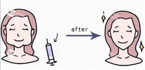 打針瘦臉卡通圖