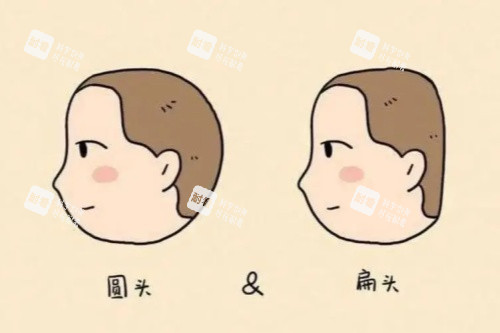圓頭扁頭卡通對比圖