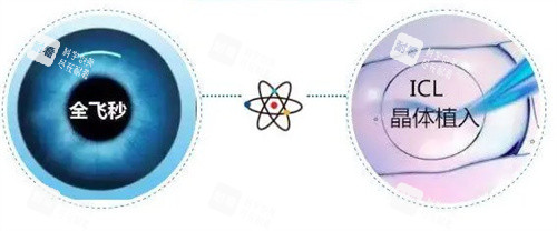 全飛秒和晶體植入