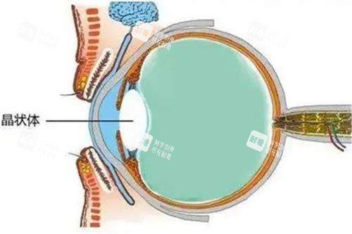 老花眼手術(shù) 老花眼手術(shù)