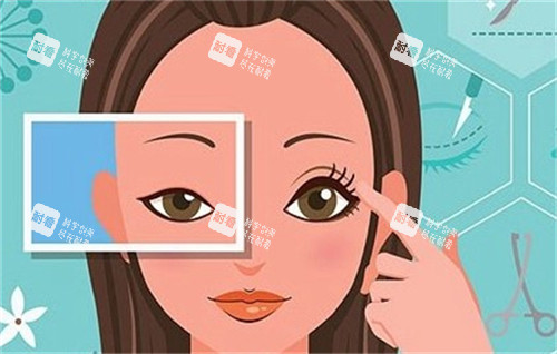 雙眼皮手術(shù)前后對比