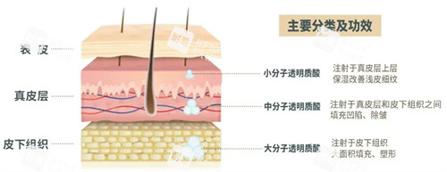 玻尿酸注射后皮膚變化