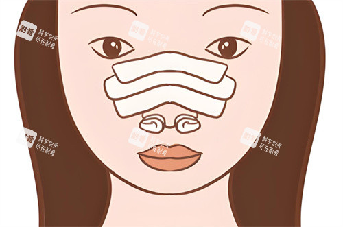 隆鼻修復(fù)術(shù)后圖