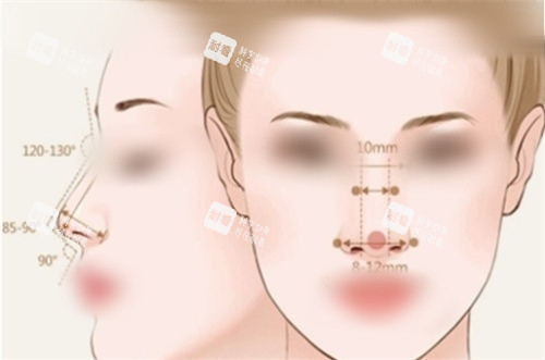 隆鼻后正面?zhèn)让嬲故緢D 隆鼻后正面?zhèn)让嬲故緢D