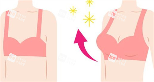 隆胸前后對比