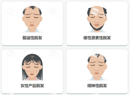 不同脫發(fā)類(lèi)型