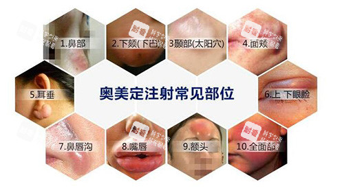 奧美定注射危害有哪些