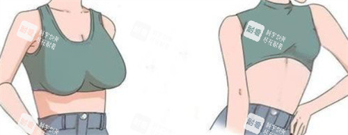 巨乳縮小 巨乳縮小