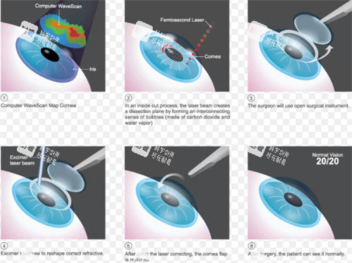 全飛秒過程演示