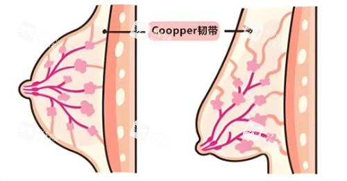乳房下垂韌帶組織對比