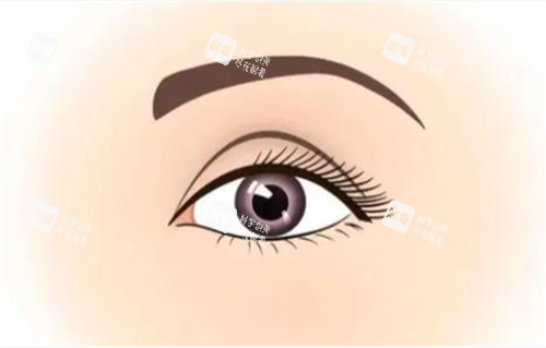 雙眼皮術(shù)后展示