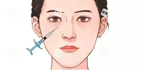 淚溝注射填充位置展示動(dòng)畫圖