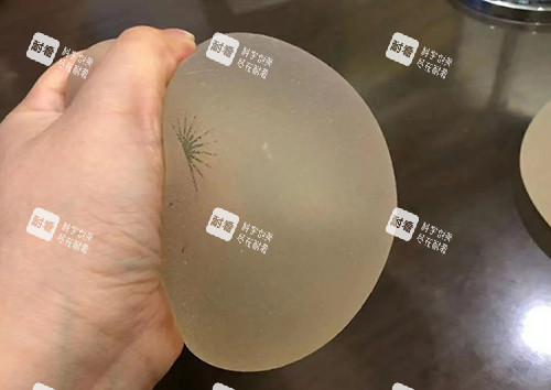 豐胸手術(shù)傲諾拉璀璨揉捏展示圖