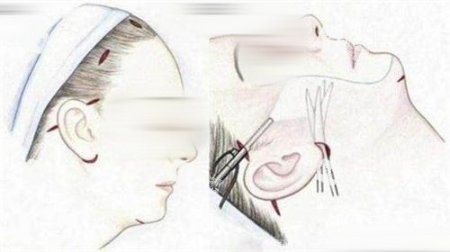 拉皮選劉文閣還是魏廣運？從排名、滿意度到價格，一篇說清誰更值