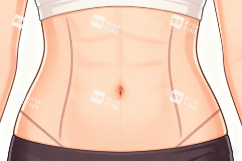 產(chǎn)后媽媽福音！崔鑫腹壁成形術助您重拾緊致腹部！