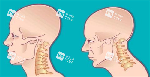 富貴包吸脂避坑指南：李發(fā)成醫(yī)生技術優(yōu)勢與費用詳解，一篇說透！