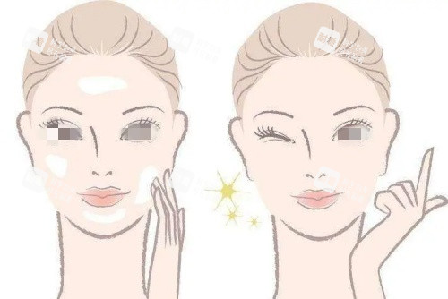 激光美白術(shù)后示意圖_副本