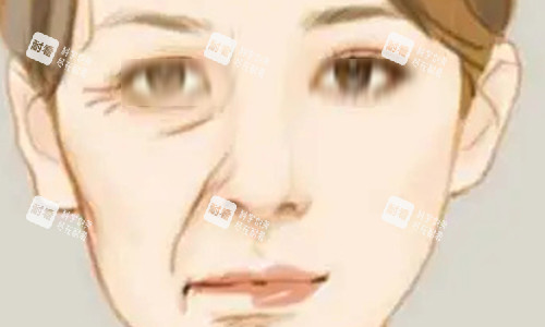 拉皮手術(shù)的對(duì)比動(dòng)畫(huà)圖