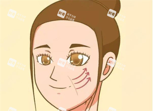 拉皮手術(shù)圖片 拉皮手術(shù)圖片