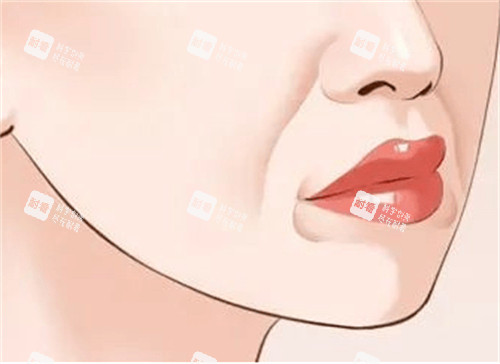 口角囊袋示意圖