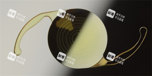 番禺區(qū)普瑞眼科醫(yī)院怎么樣？在屈光手術（近視矯正）中心和兒童視光?？品矫姹憩F(xiàn)好的狠！