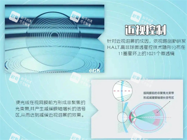 近視控制原理圖解