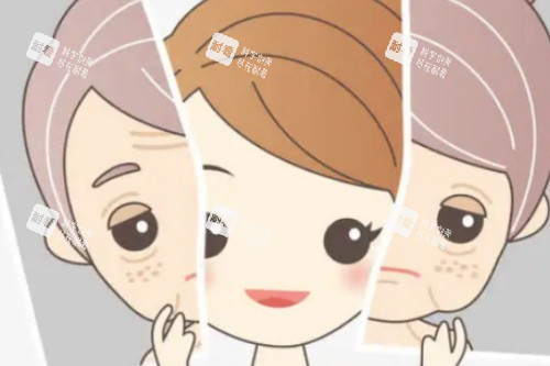 面部提升卡通展示圖