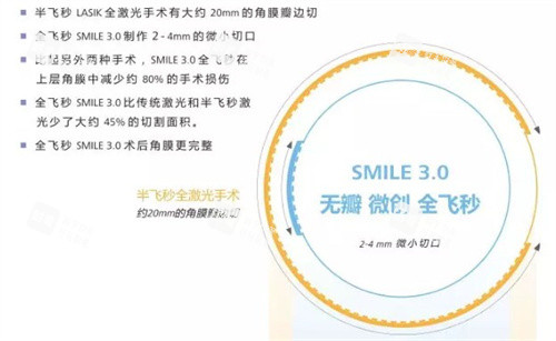全飛秒手術(shù)3.0