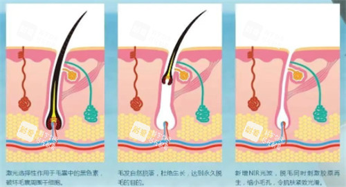 北京光子嫩膚2026收費(fèi)價(jià)格一覽：M22超光子等主流設(shè)備價(jià)目與性價(jià)比分析