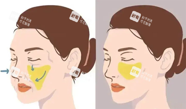 饅化針到底能不能打？正規(guī)大白講解功效作用，適用人群與風(fēng)險(xiǎn)全揭秘