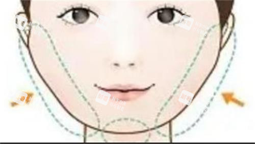 磨骨手術的部位