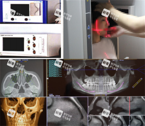 杭州連天美整形高俊明磨骨術(shù)前檢查