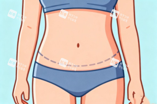 腹部吸脂卡通圖一覽