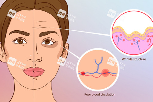 注射玻尿酸前后對(duì)比