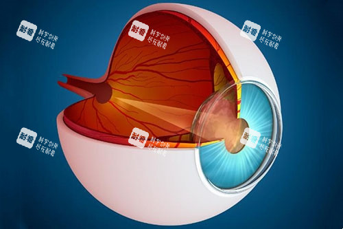 青光眼卡通圖片展示