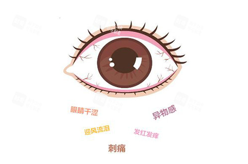 干眼癥有哪些表現(xiàn)